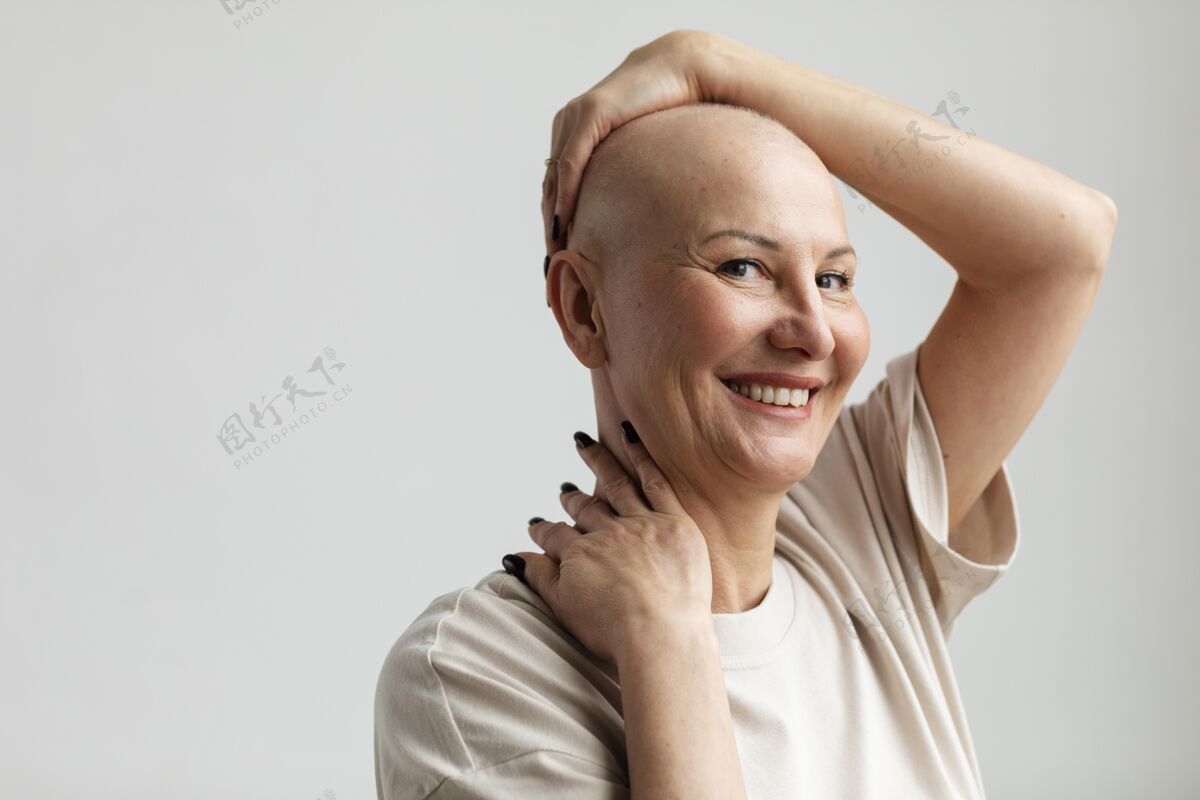 肖像皮肤癌中年妇女画像女性医疗保健