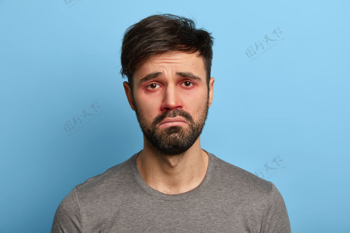 年轻可怜不悦的男人有病态的表情 红肿的眼睛 傻笑的脸 患有结膜炎 季节性过敏 对蓝色墙壁摆姿势人 疾病 健康问题的概念生病胡子痛苦